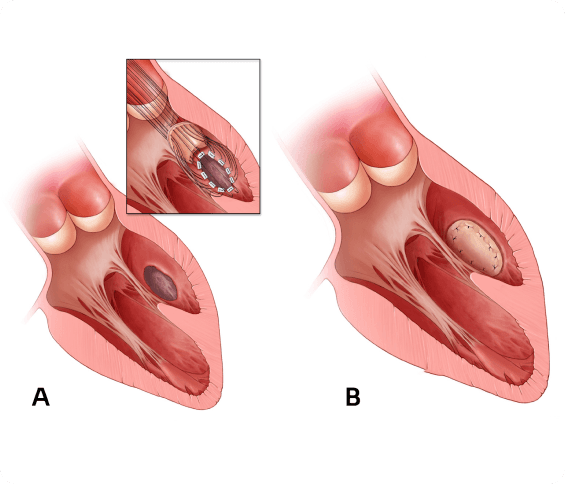 Procedure