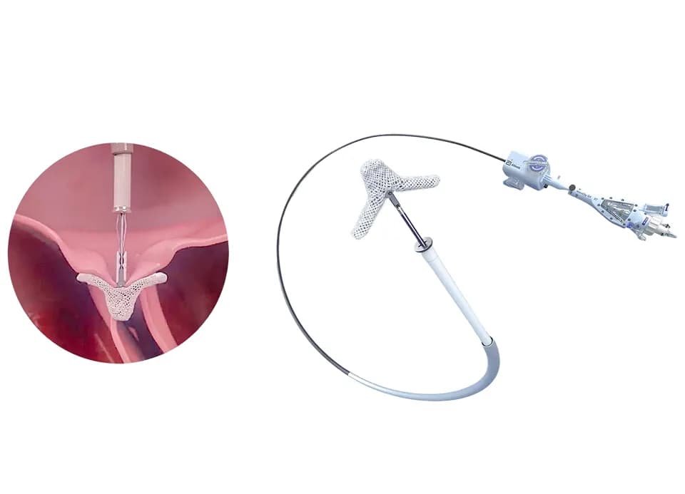 MitraClip / Transcatheter Edge-to-Edge Repair (TEER)