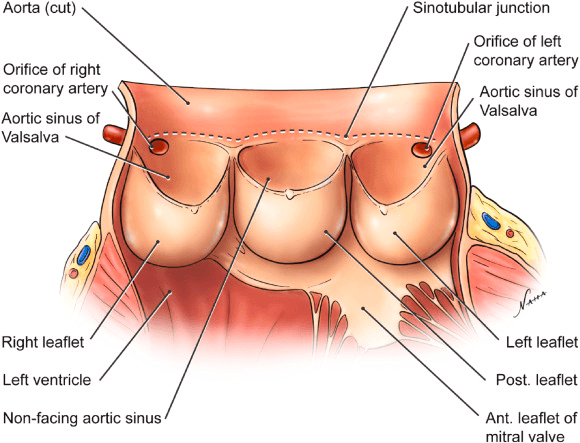 TEER Surgery