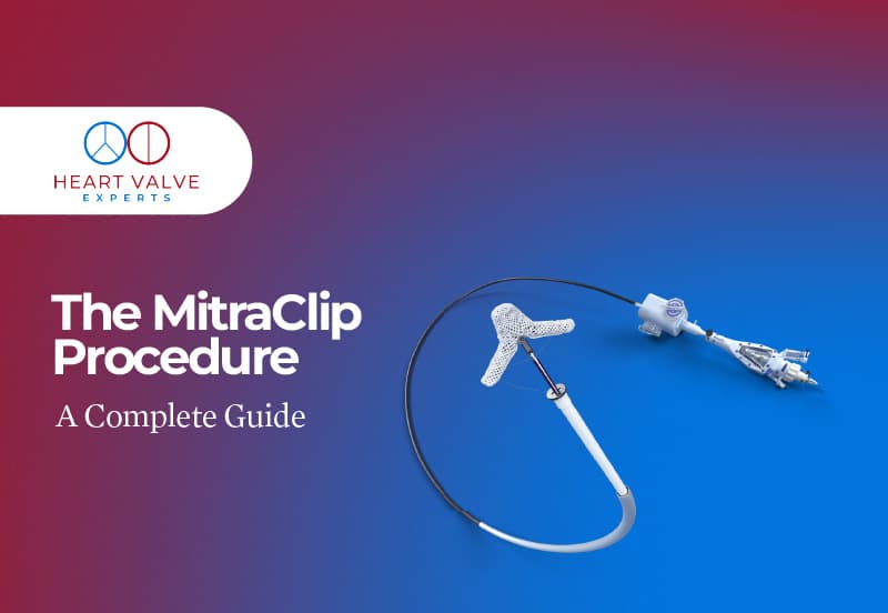 The MitraClip Procedure: A Complete Guide to Non-Surgical Mitral Valve Repair