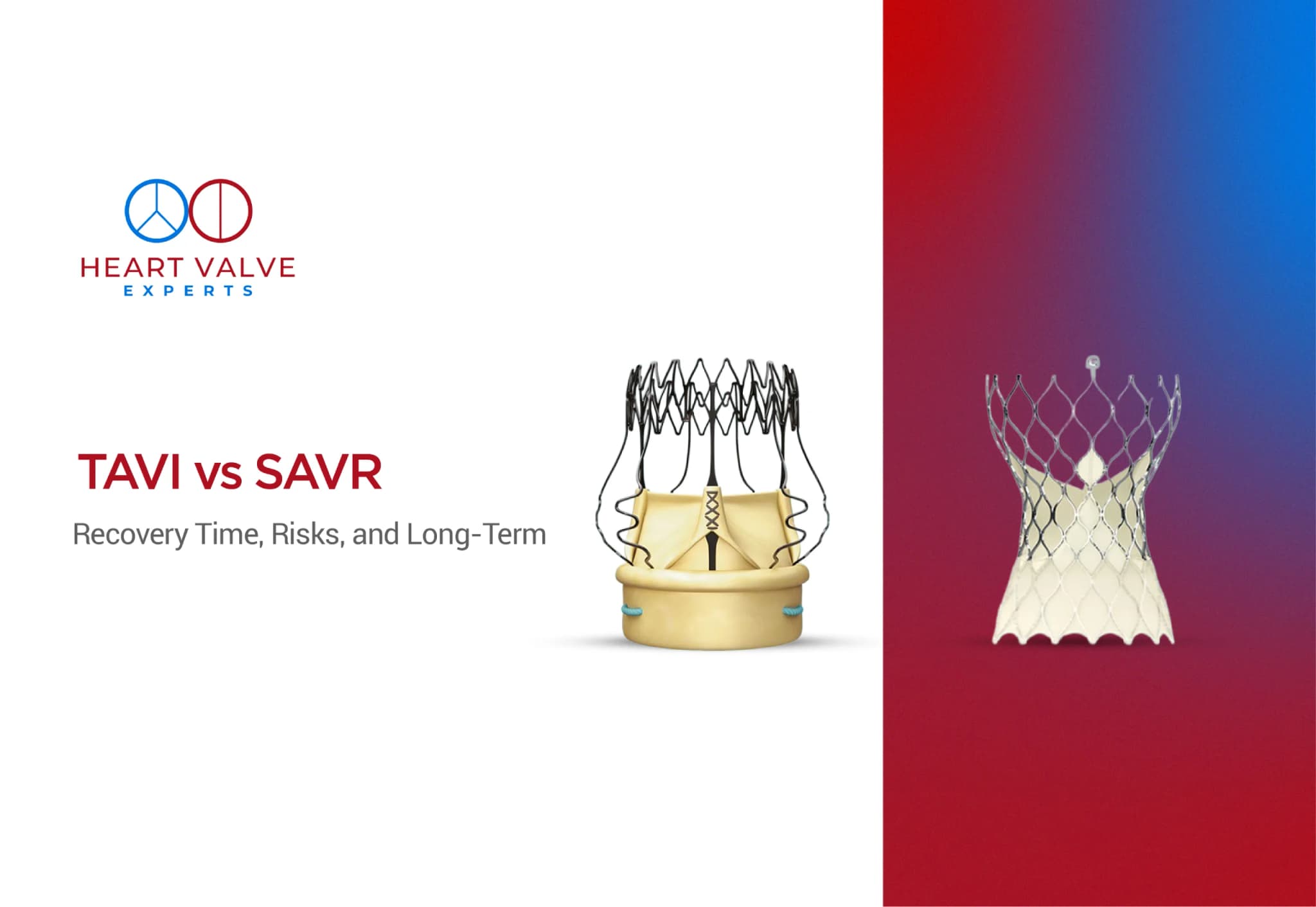 TAVI vs SAVR: Recovery, Risks, and Long-Term Results