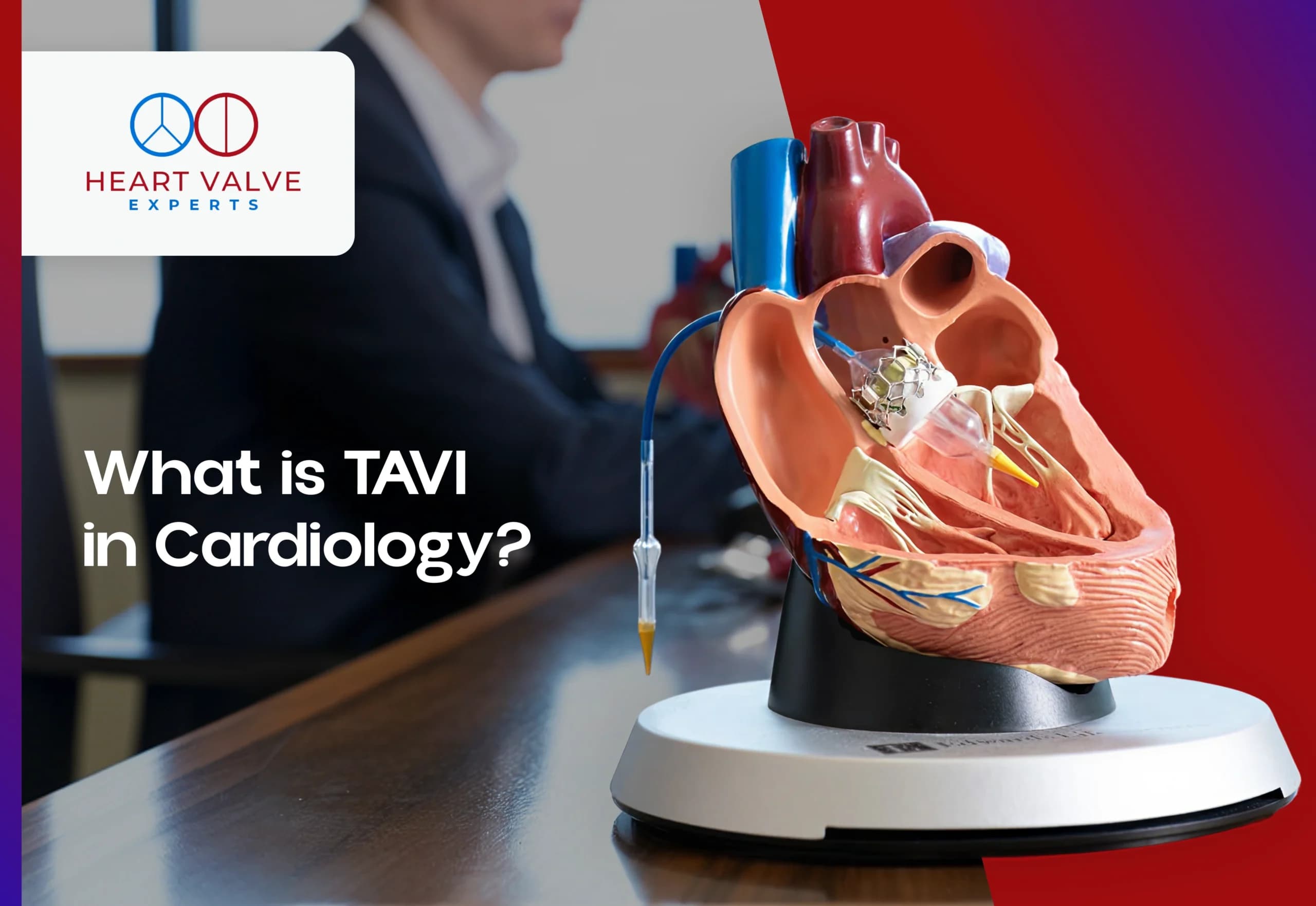 What is TAVI in Cardiology? A Complete Guide