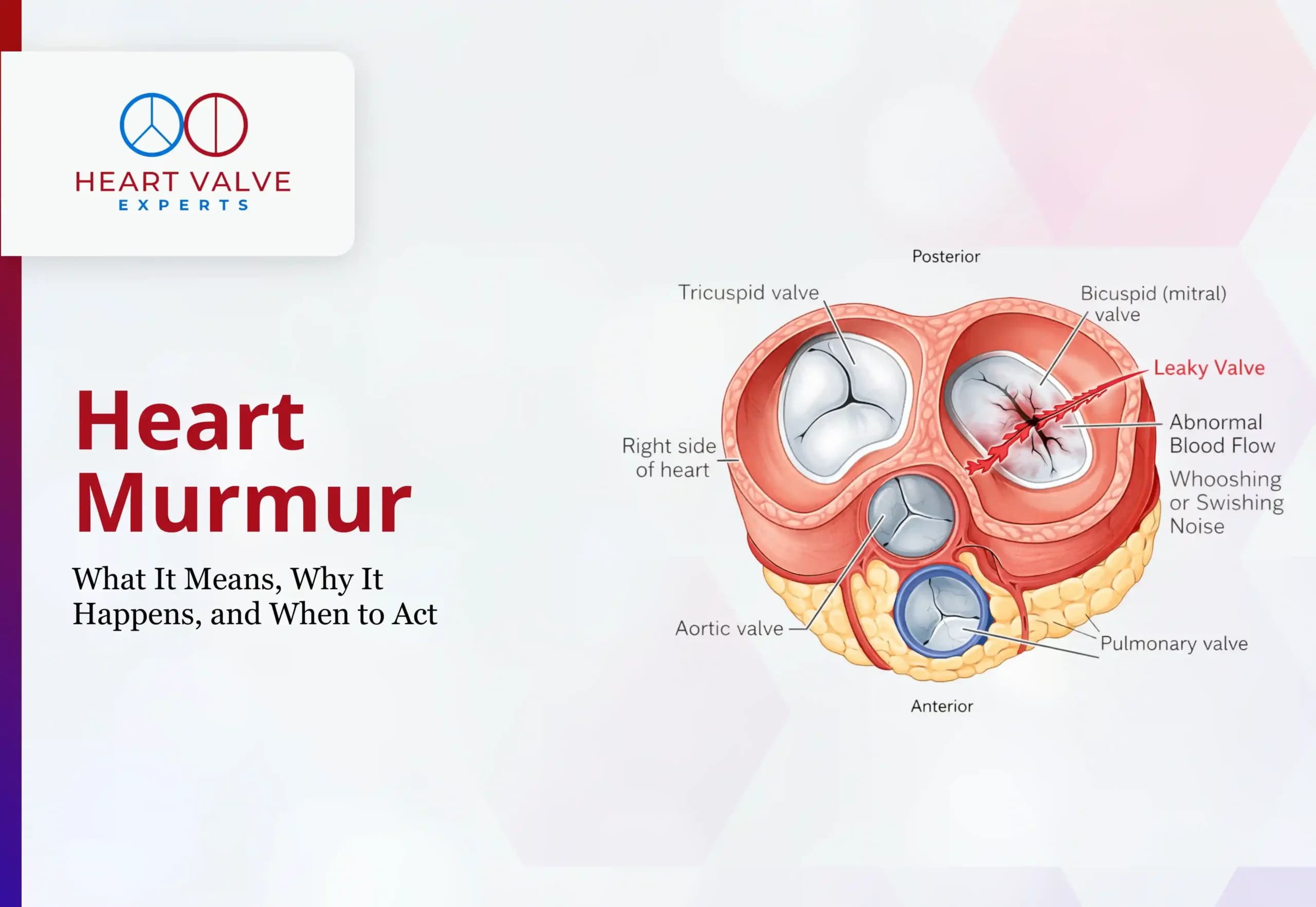 Heart Murmur: What It Means, Why It Happens, and When to Act