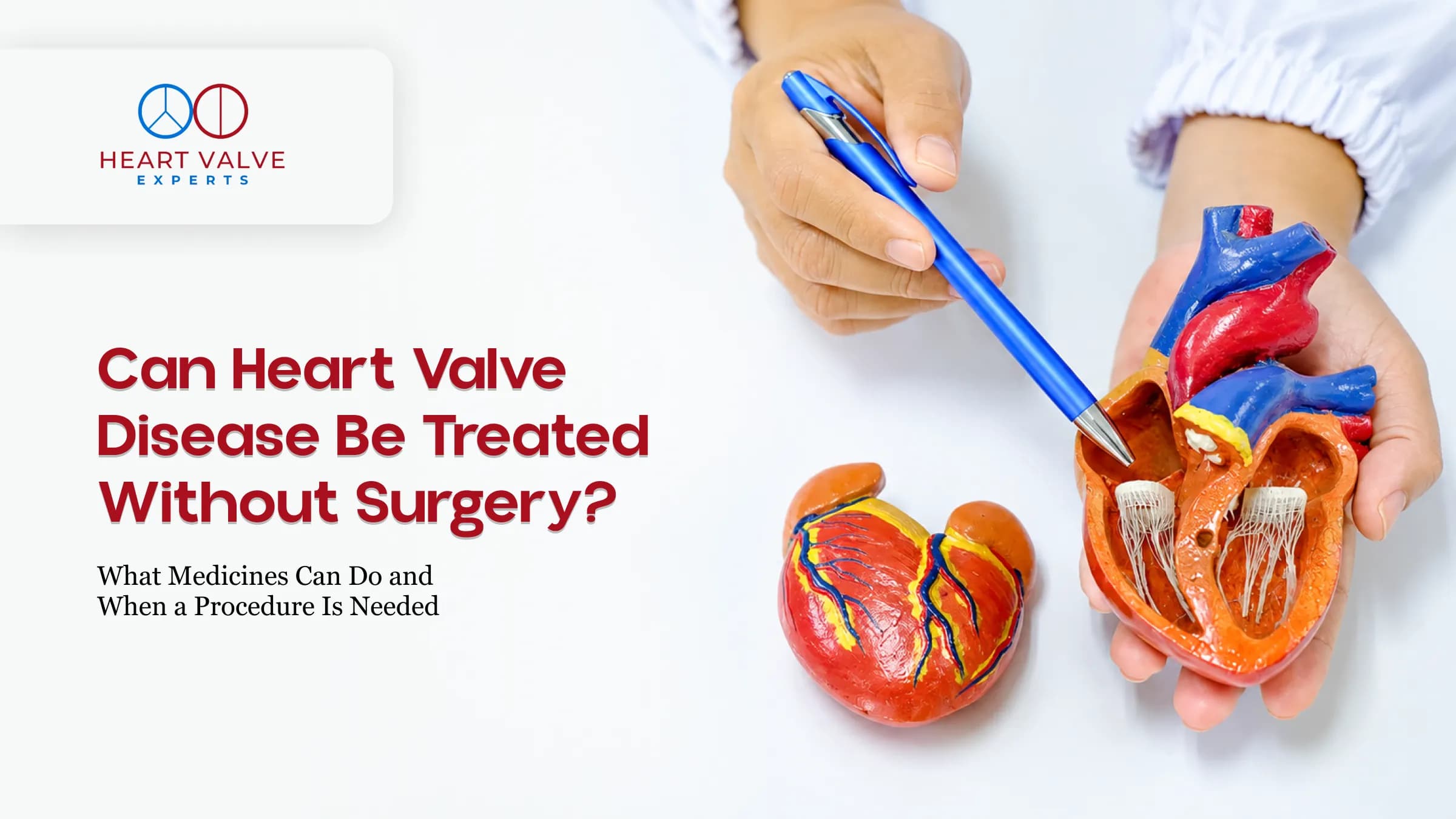 Can Heart Valve Disease Be Treated Without Surgery? What Medicines Can Do and When a Procedure Is Needed