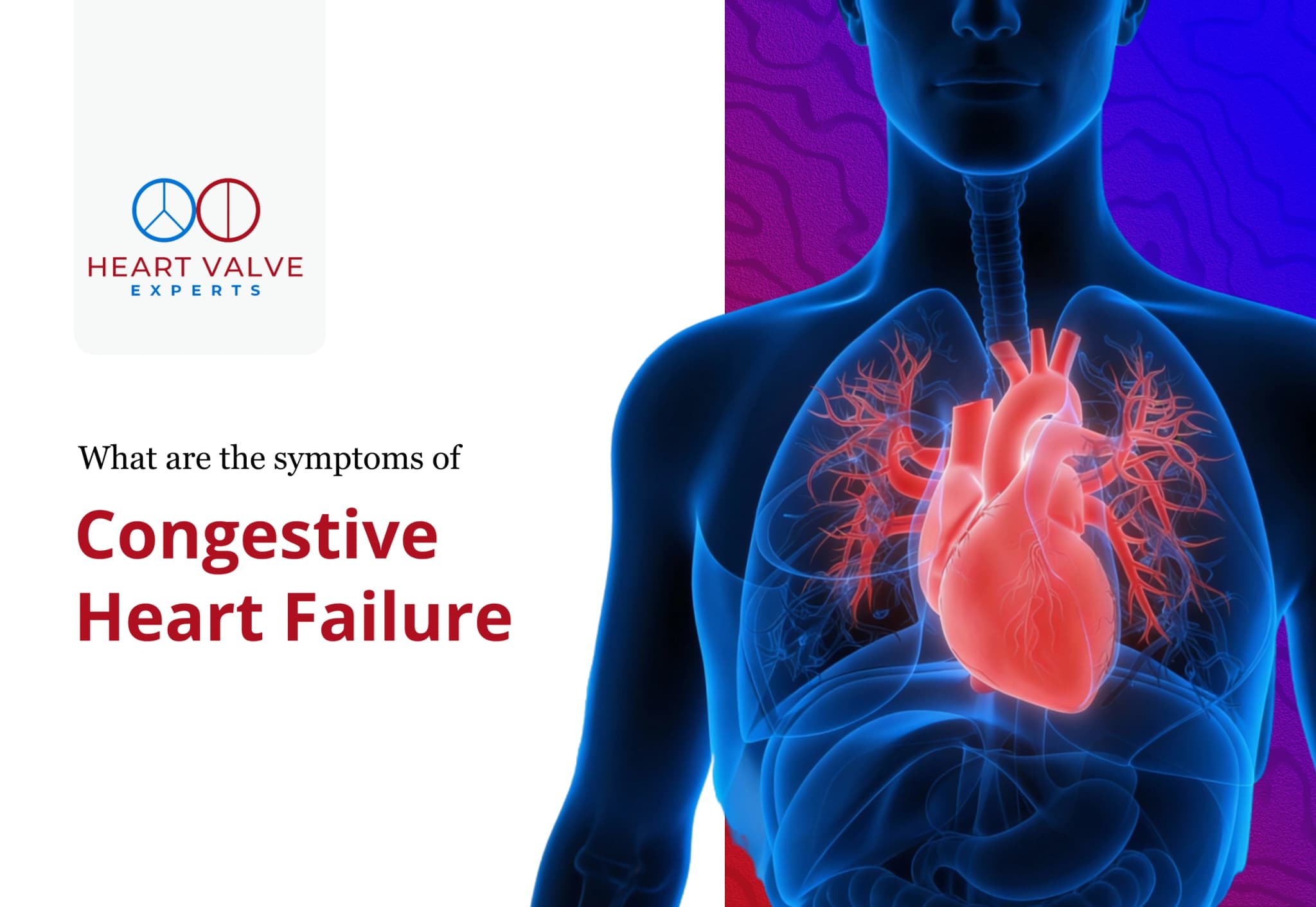 What Are the Symptoms of Congestive Heart Failure?