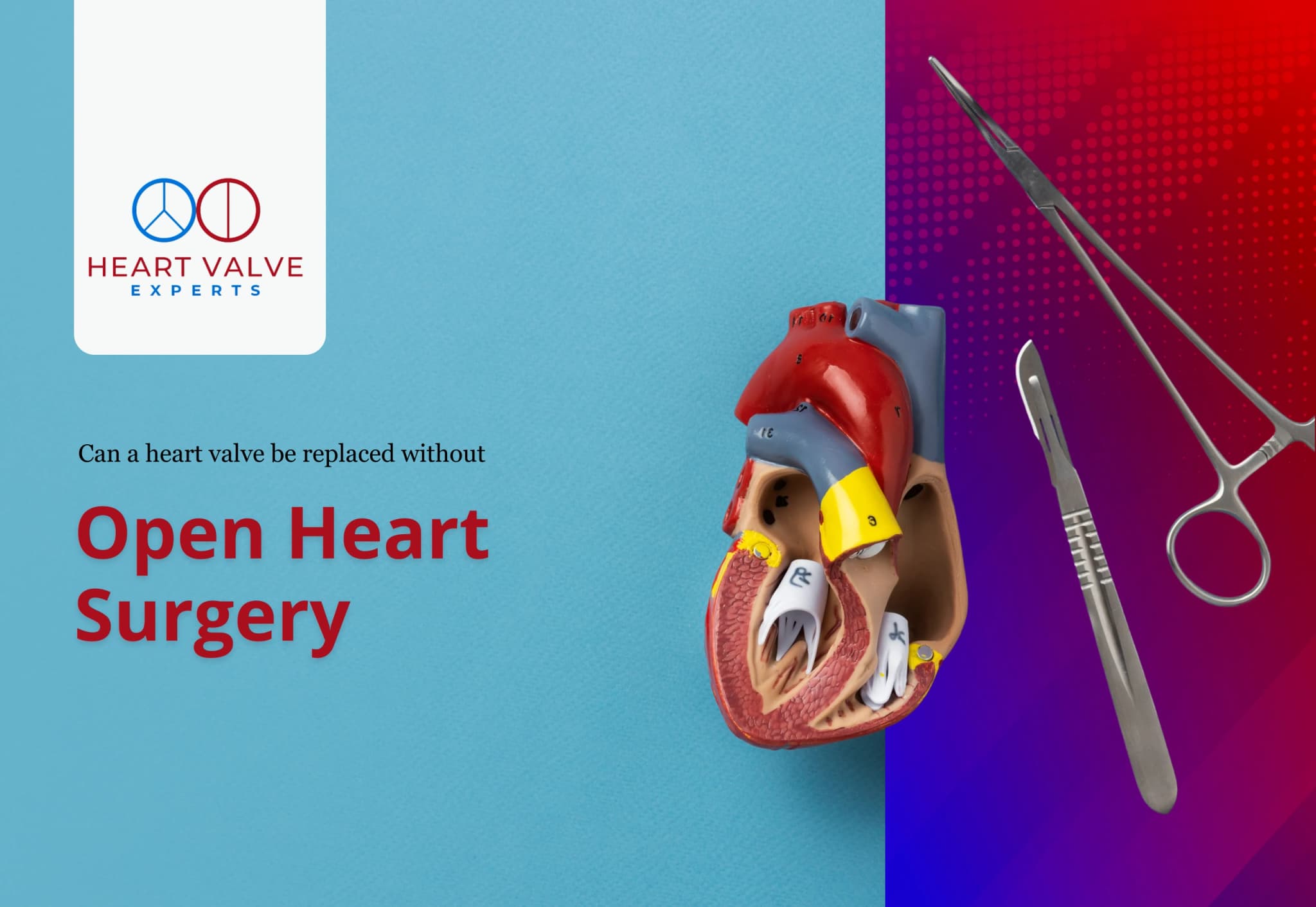 Can a Heart Valve Be Replaced Without Open Heart Surgery? Options, Eligibility, and What to Know