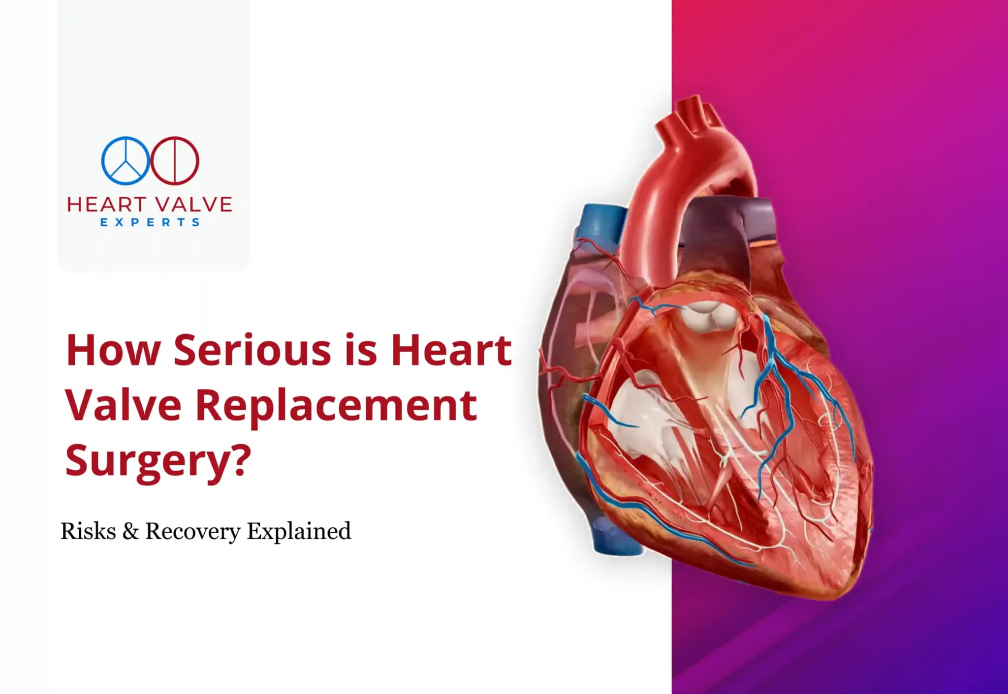How Serious Is Heart Valve Replacement Surgery?