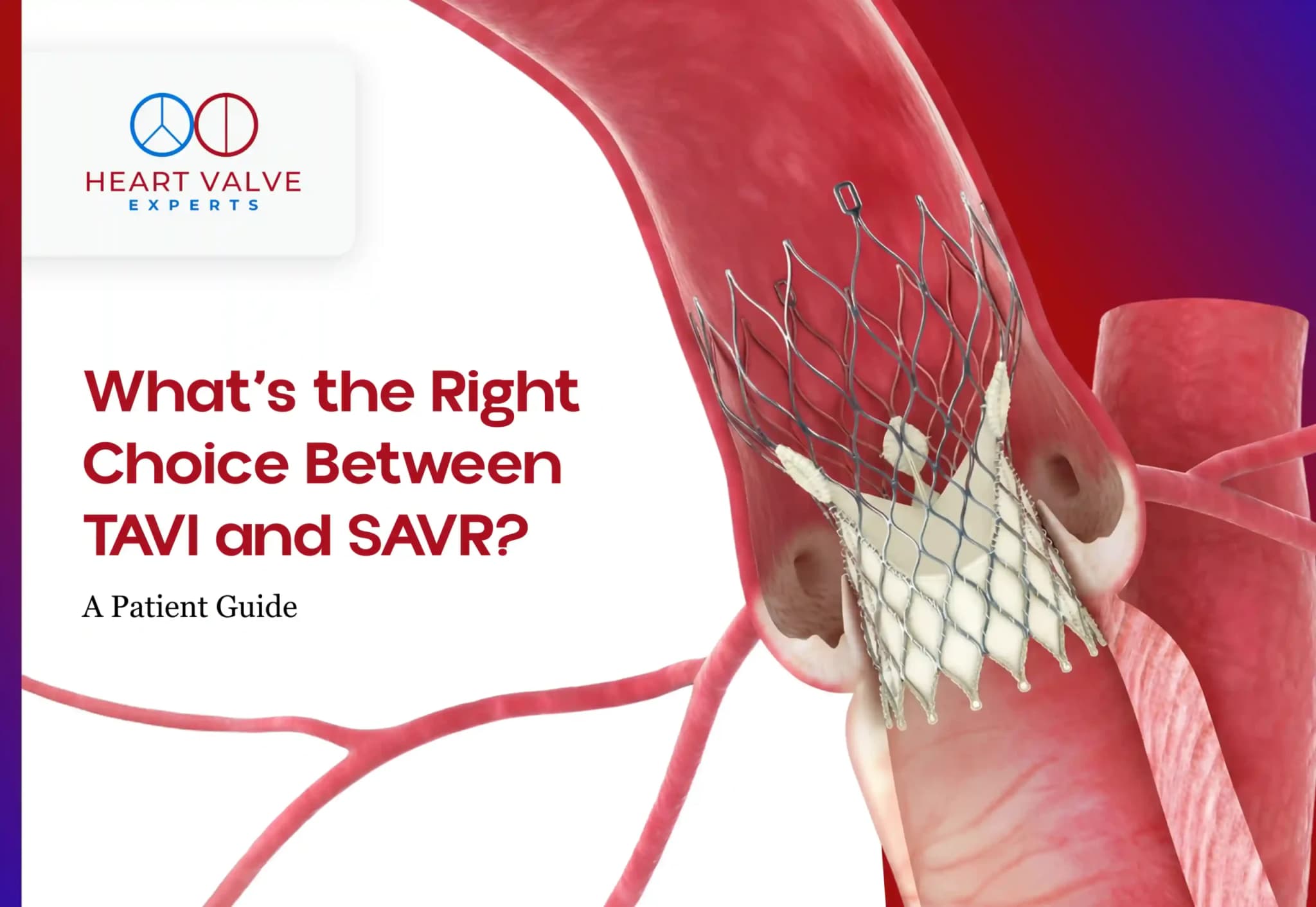 What’s the Right Choice Between TAVI and SAVR?