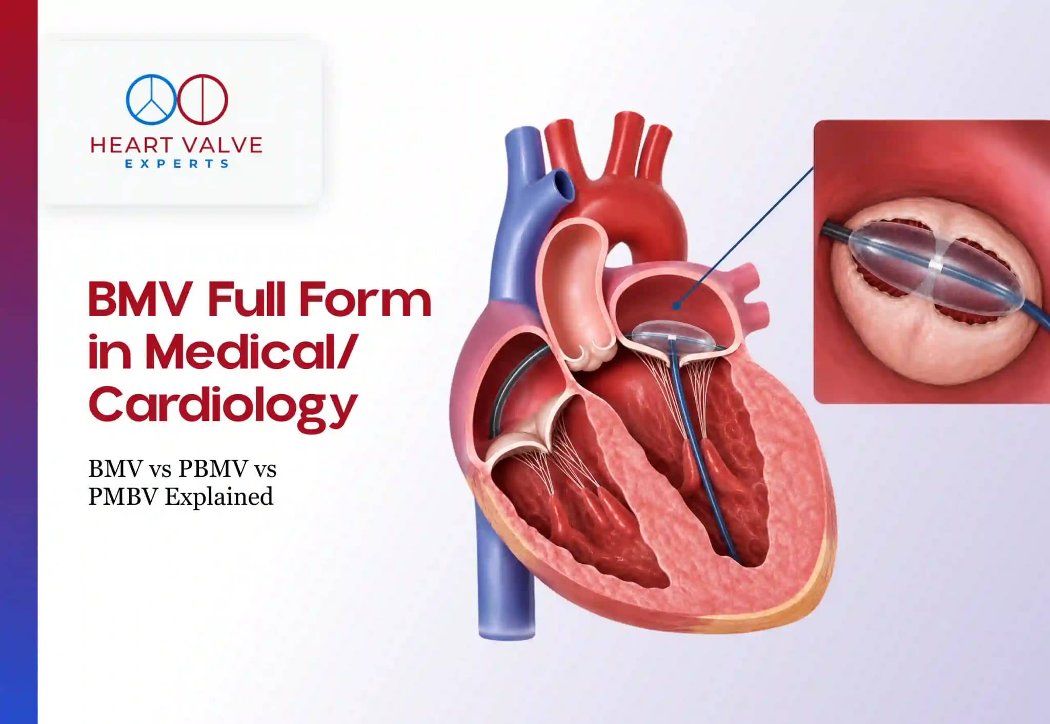BMV vs PBMV vs PMBV: What Is the Difference?