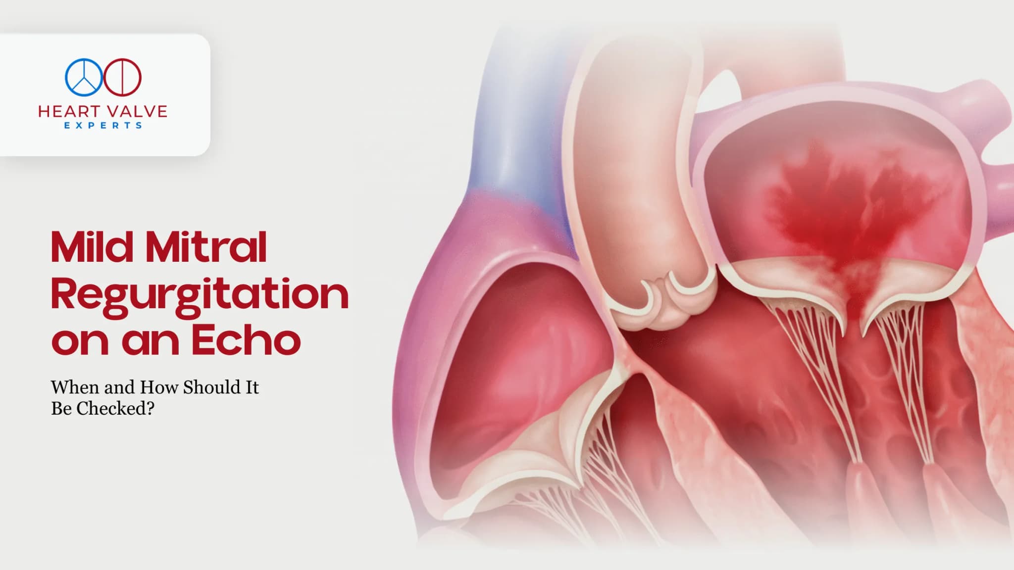 Mild Mitral Regurgitation on an Echo: When and How Should It Be Checked?