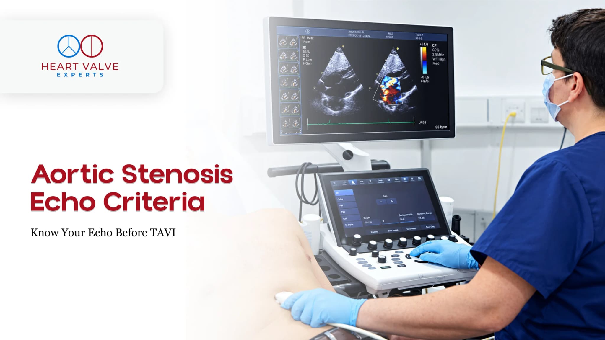 Aortic Stenosis Echo Criteria Explained: Understanding Your Echo Before a TAVI Assessment