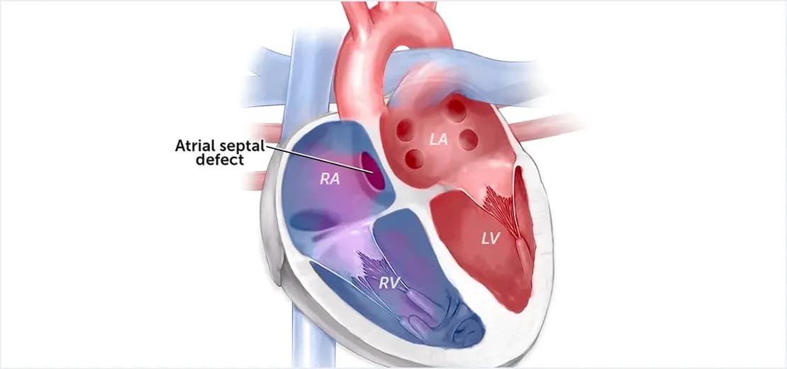 Assessment for Children With Congenital Heart Conditions