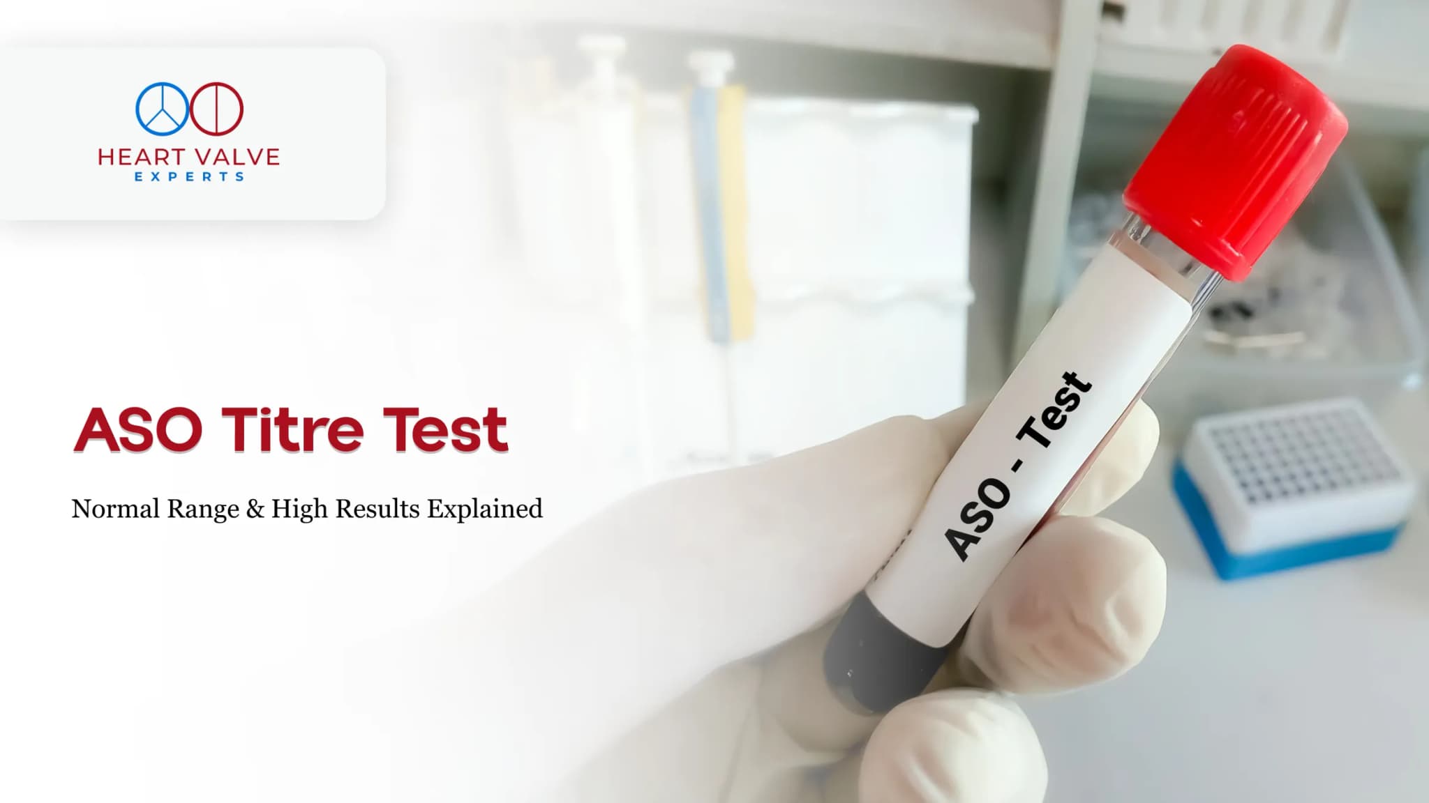 ASO Titre Test: Normal Range and What a High ASO Result Means