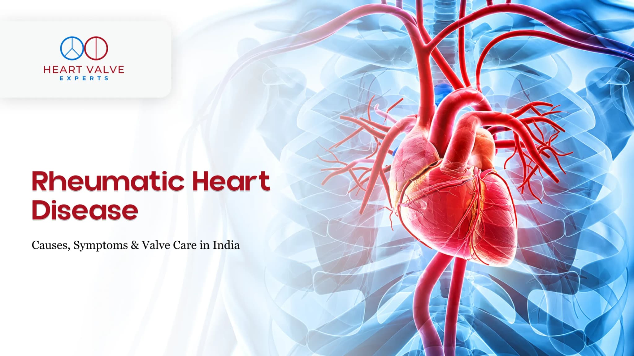 Rheumatic Heart Disease – Causes, Symptoms, Treatment