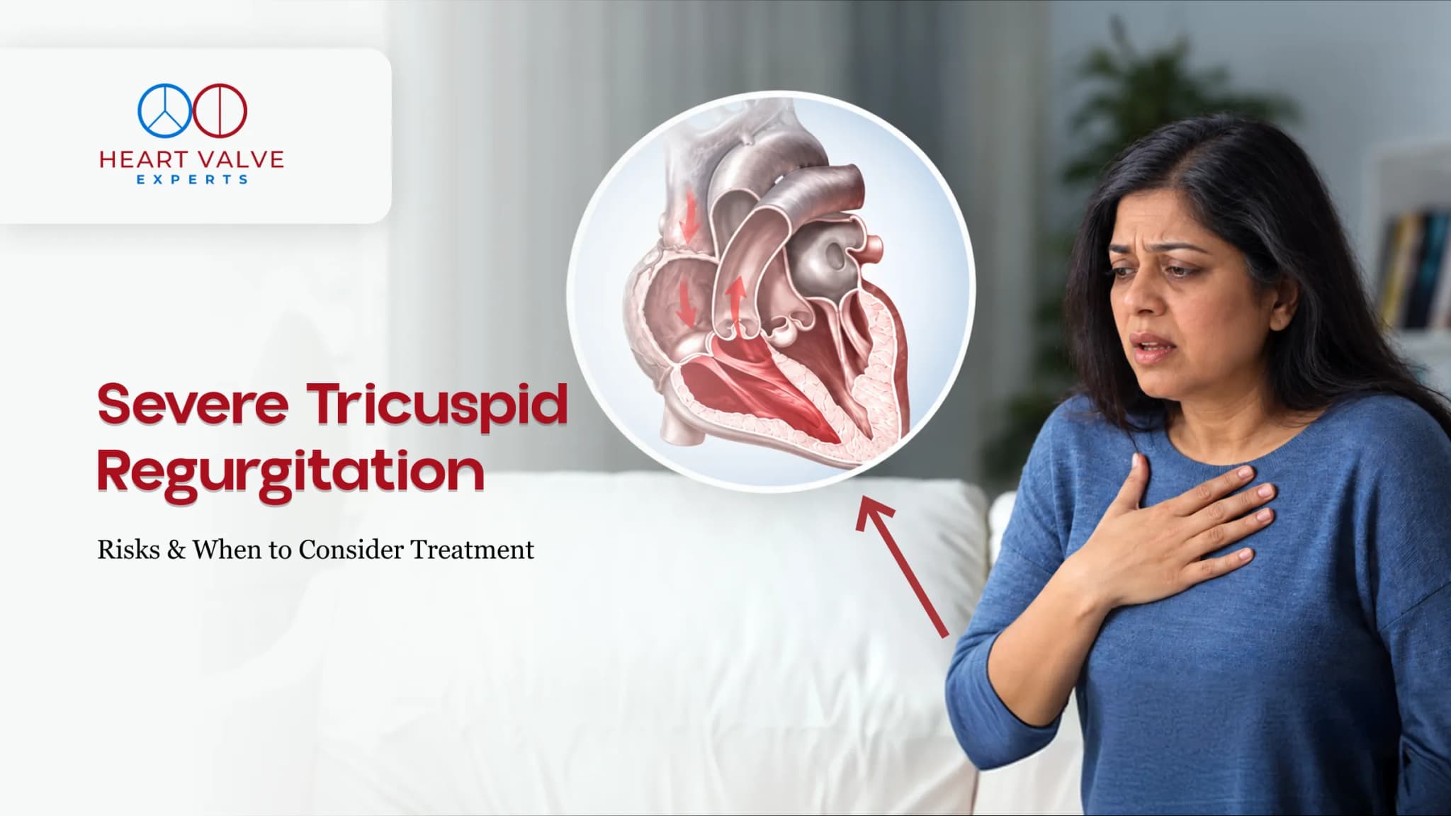 Severe Tricuspid Regurgitation and Treatment