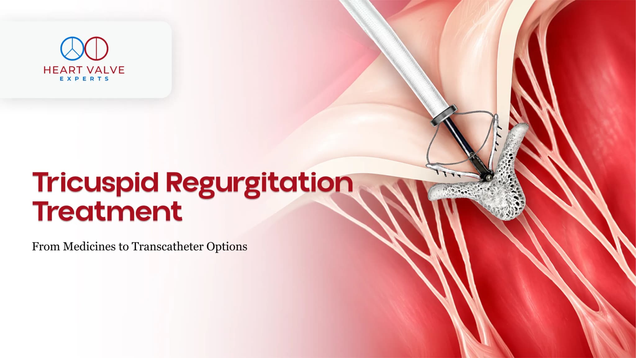 Tricuspid Regurgitation Symptoms and The Right-Heart Warning Signs