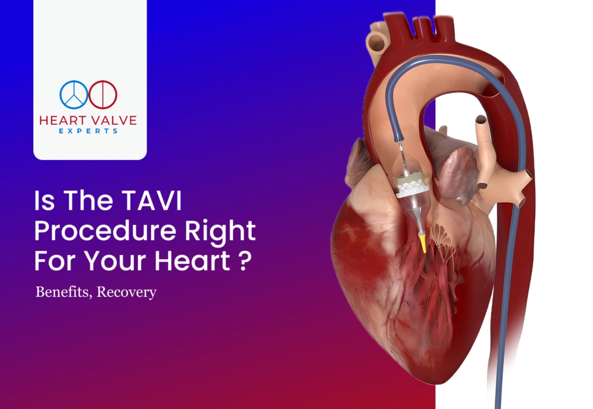 Direct Flow Tavi What Is the Cardiac Cycle? Phases, Function and Heart Health