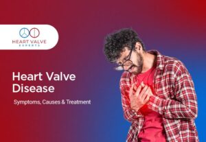 heart valve disease symptoms causes and treatment