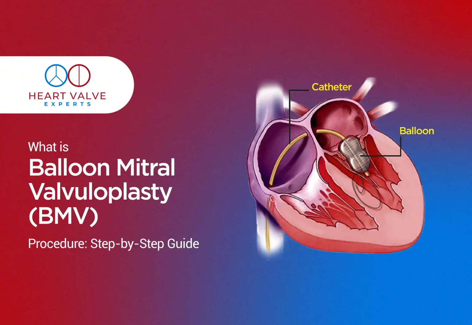 bmv procedure