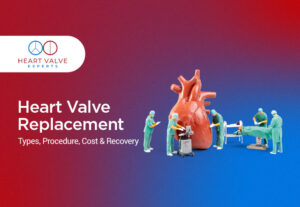 Heart Valve Replacement: Types, Procedure, Cost and Recovery heart valve replacement procedure cost recovery