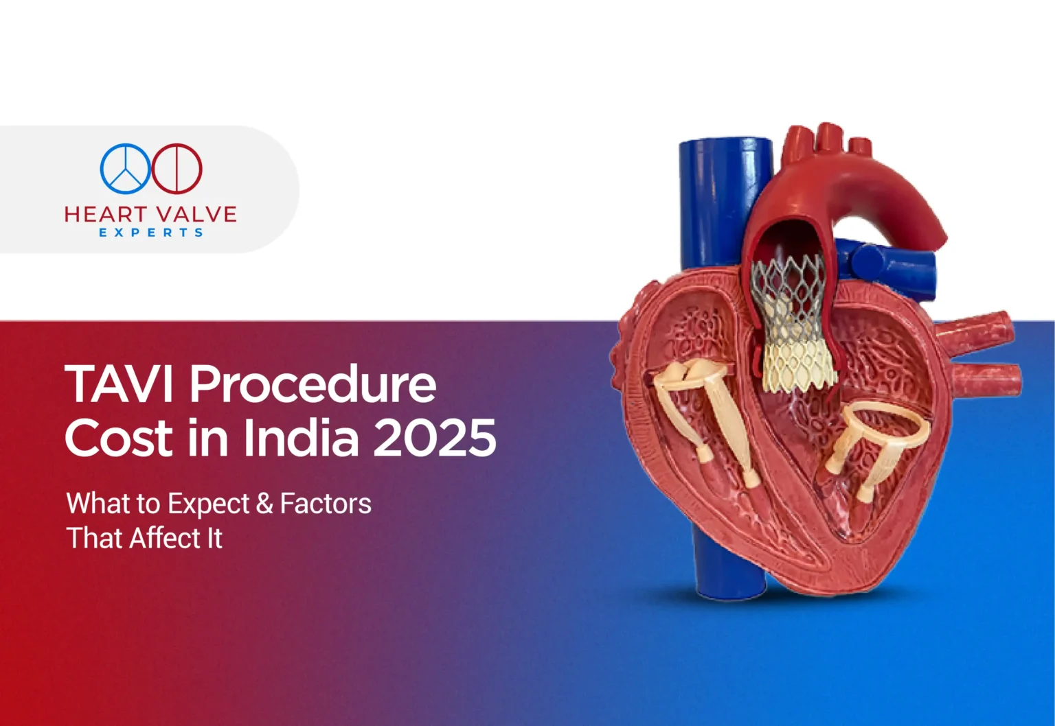 tavi procedure cost in india