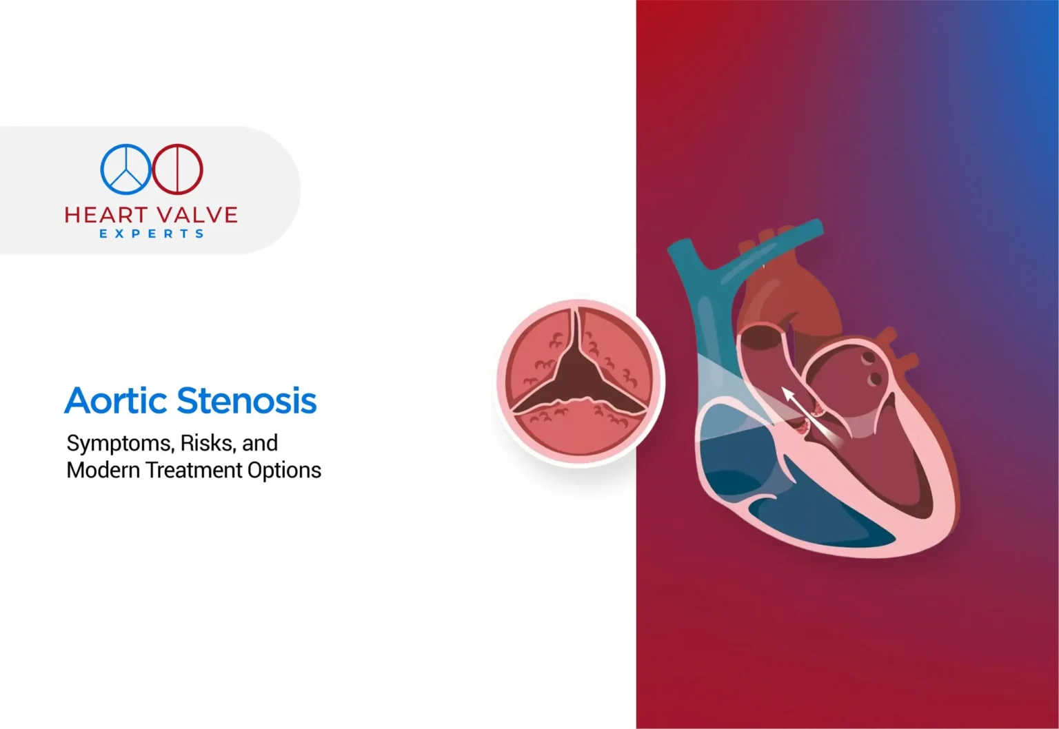 aortic stenosis