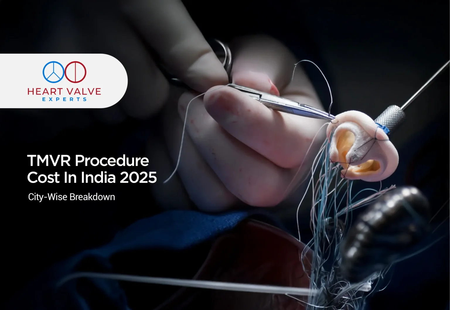 tmvr procedure cost in india